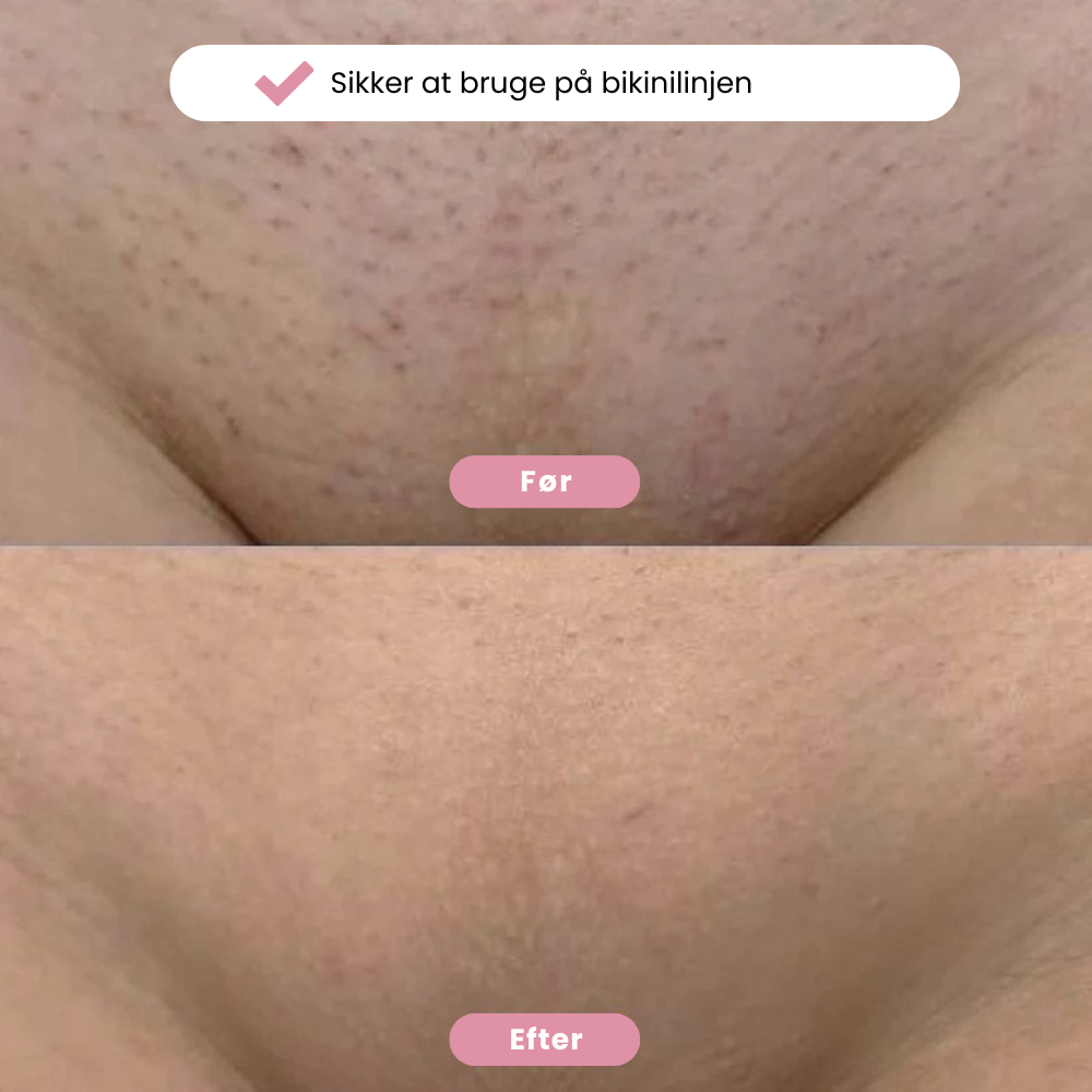 Eulyte TM Bikintrimmer