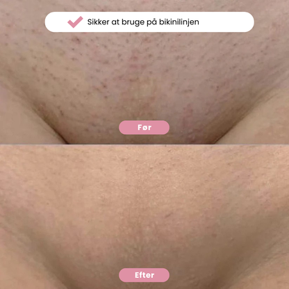 Eulyte TM Bikintrimmer