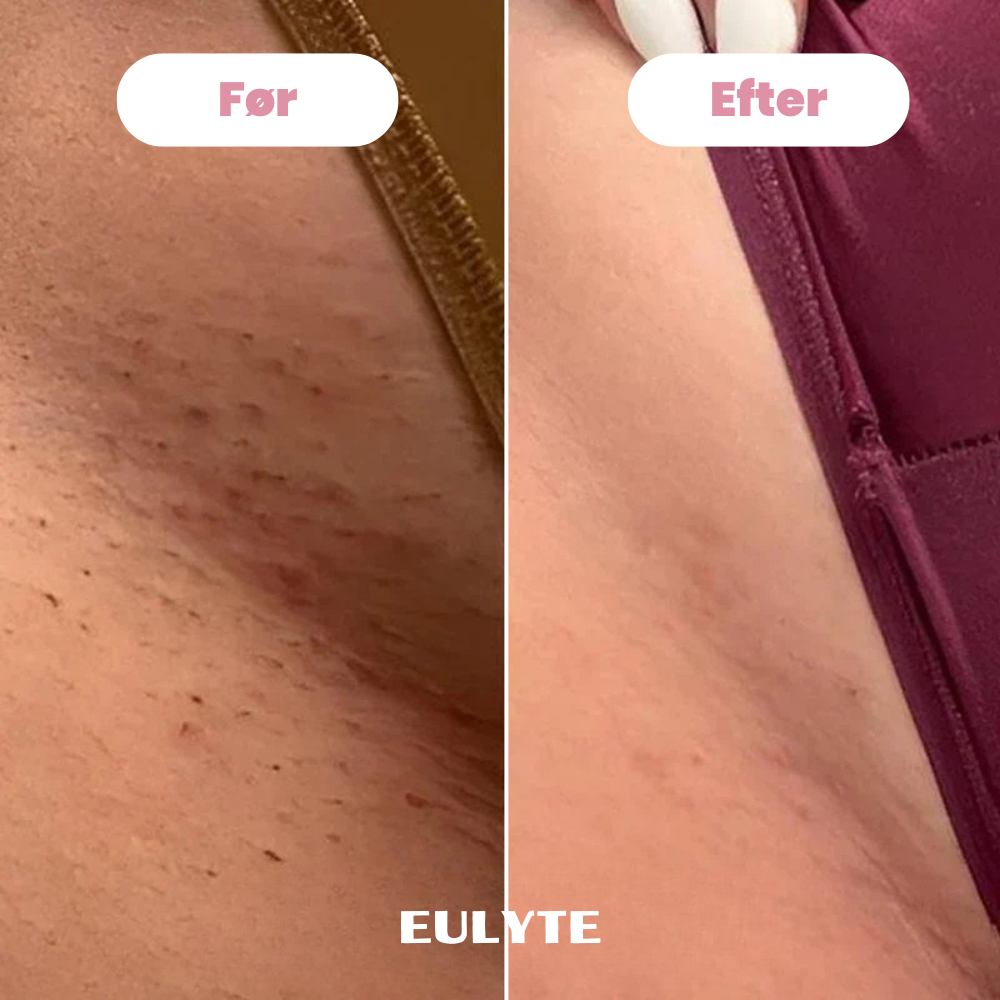 Eulyte TM Bikintrimmer