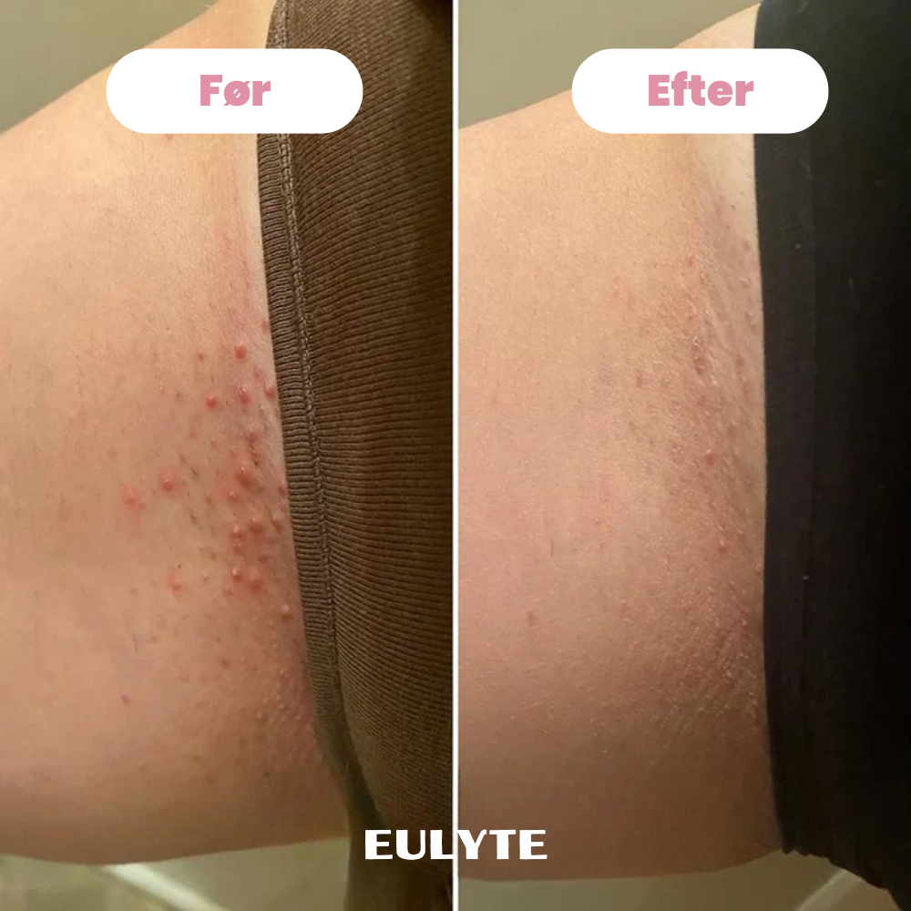 Eulyte TM Bikintrimmer