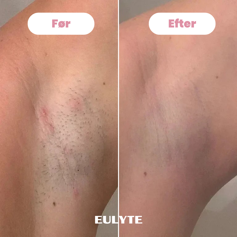 Eulyte TM Bikintrimmer
